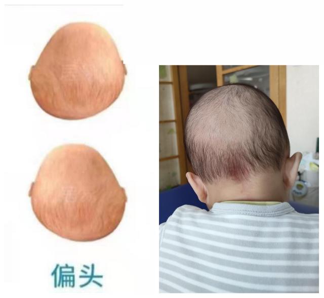 宝宝适合什么样的睡觉姿势？有这6种情况的家长要注意了休闲区蓝鸢梦想 - Www.slyday.coM