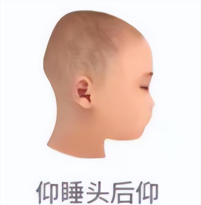 宝宝适合什么样的睡觉姿势？有这6种情况的家长要注意了休闲区蓝鸢梦想 - Www.slyday.coM