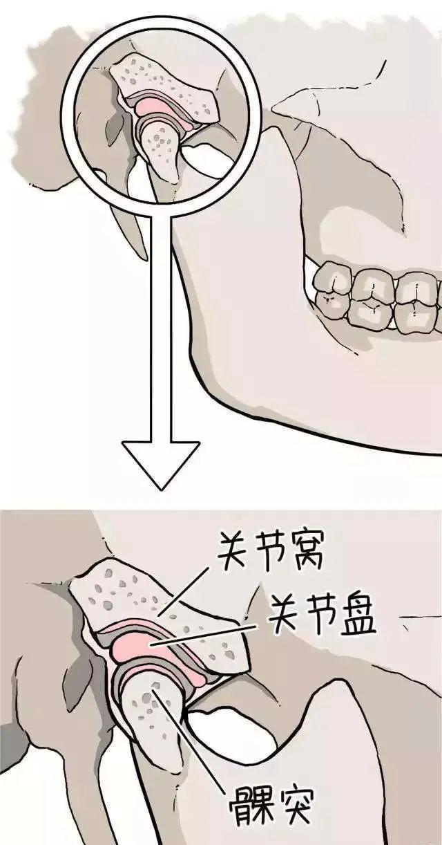 一张口就困难疼痛有弹响声当心是颞下颌关节紊乱