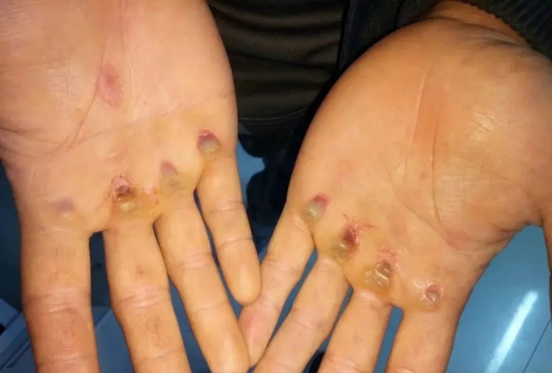 单杠卷身上1001个这兵哥太炸裂了