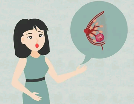 这些与乳腺癌相关的误区 你是否深信不疑?