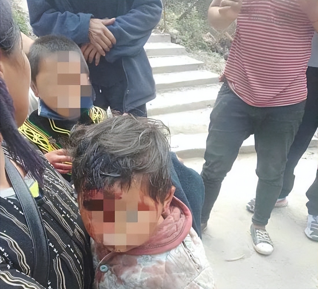 惊险至极,3岁女童在家门口玩耍被野猴拖走,为何它敢这么大胆?休闲区蓝鸢梦想 - Www.slyday.coM 惊险至极,3岁女童在家门口玩耍被野猴拖走,为何它敢这么大胆?休闲区蓝鸢梦想 - Www.slyday.coM