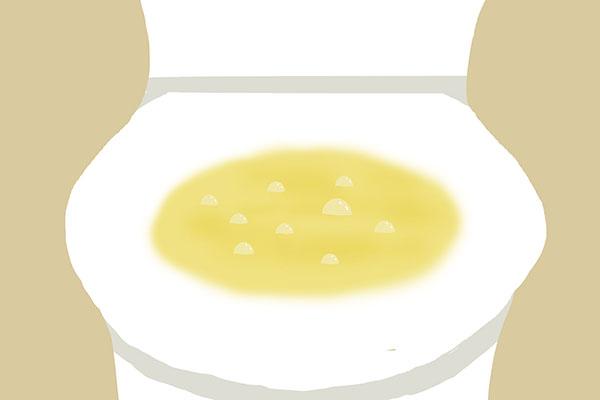 32岁男子查出肾衰竭，早前没发现水肿和血尿，却轻视了2个异常休闲区蓝鸢梦想 - Www.slyday.coM