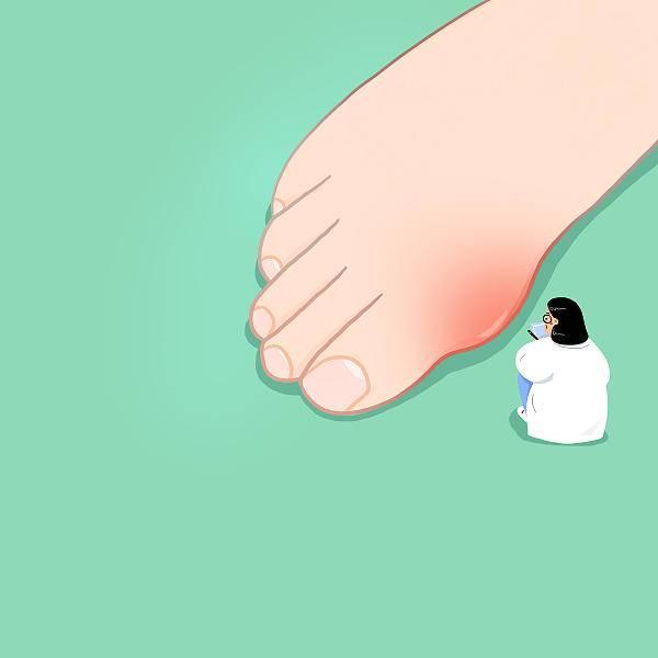 其实每10个少年儿童里就有1个|尿酸|痛风_新浪新闻