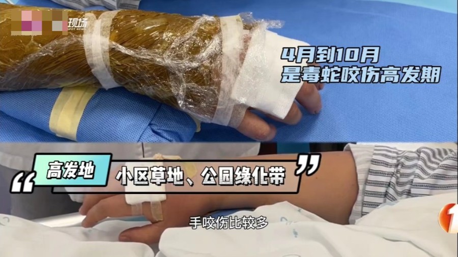 4月野物出没，一个月内34人被咬伤住院！医生提醒：这4种错误处理方式会致命！休闲区蓝鸢梦想 - Www.slyday.coM