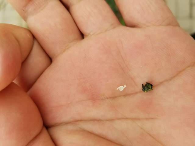 农村古法熏牙能从耳朵熏出牙虫虫子从哪来古法传人说出内情