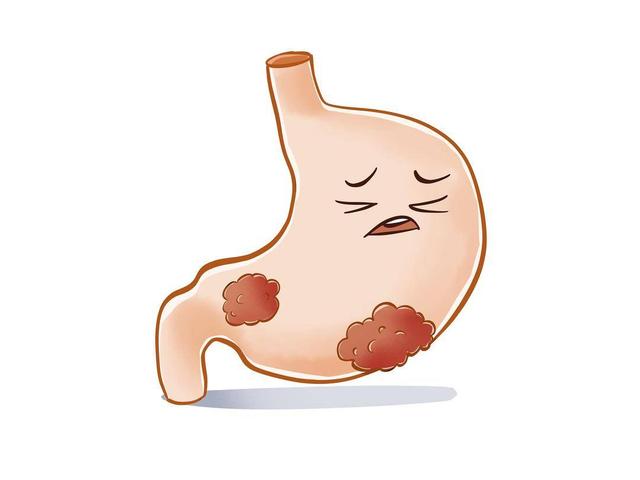 癌症|胃癌_新浪新闻