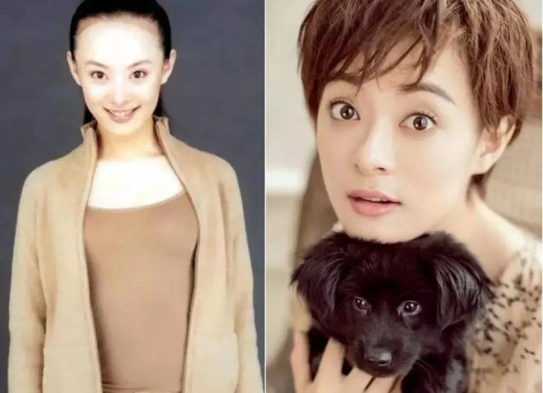 大脑门过度填充这7位女星被丑额头拖累得好惨