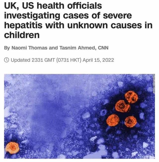 世卫组织：预计不明原因儿童肝炎将出现更多病例，已有1人死亡休闲区蓝鸢梦想 - Www.slyday.coM