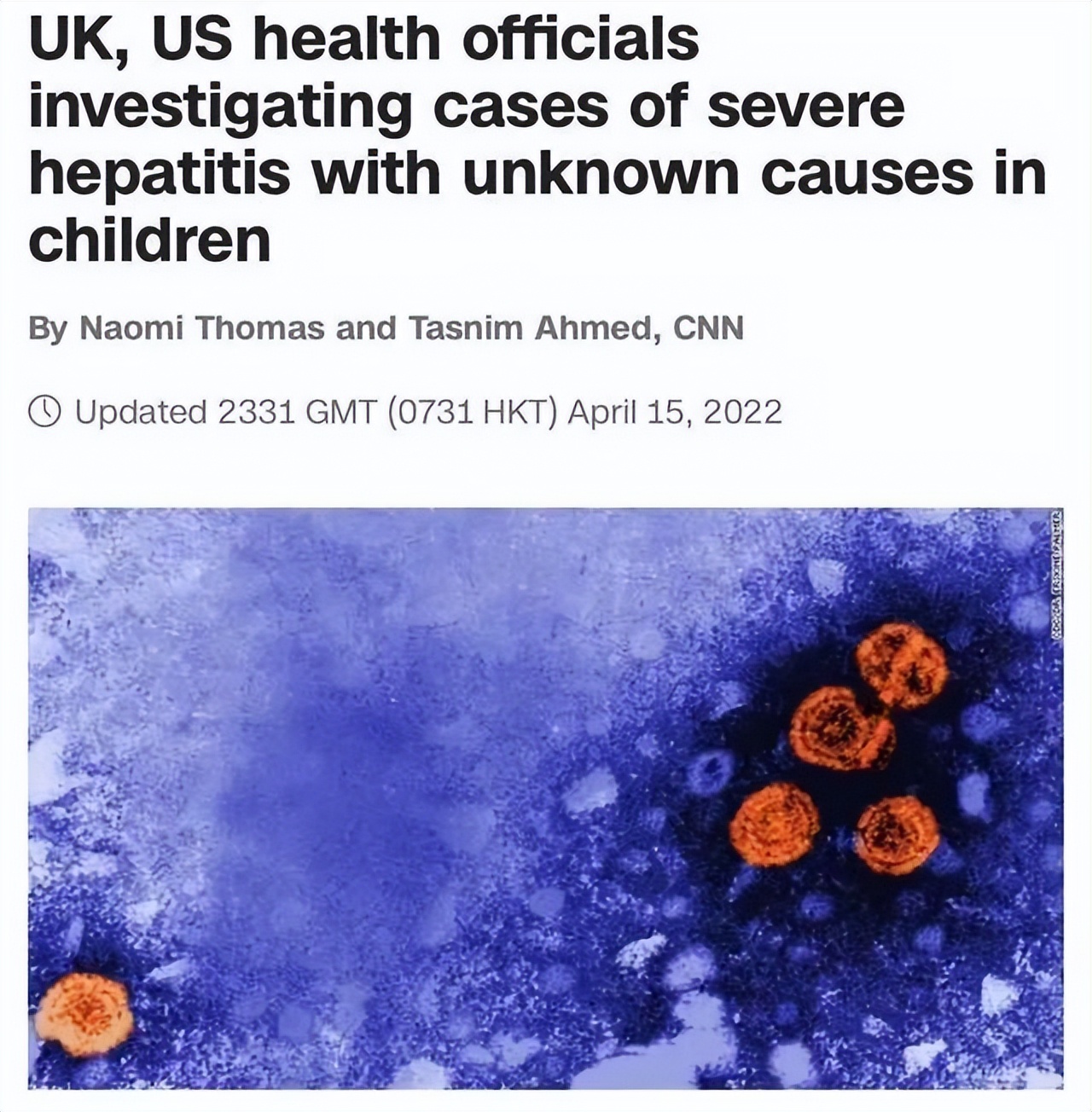 警惕!英美等多个国家出现不明原因儿童肝炎病例,已出现死亡病例休闲区蓝鸢梦想 - Www.slyday.coM 警惕!英美等多个国家出现不明原因儿童肝炎病例,已出现死亡病例休闲区蓝鸢梦想 - Www.slyday.coM