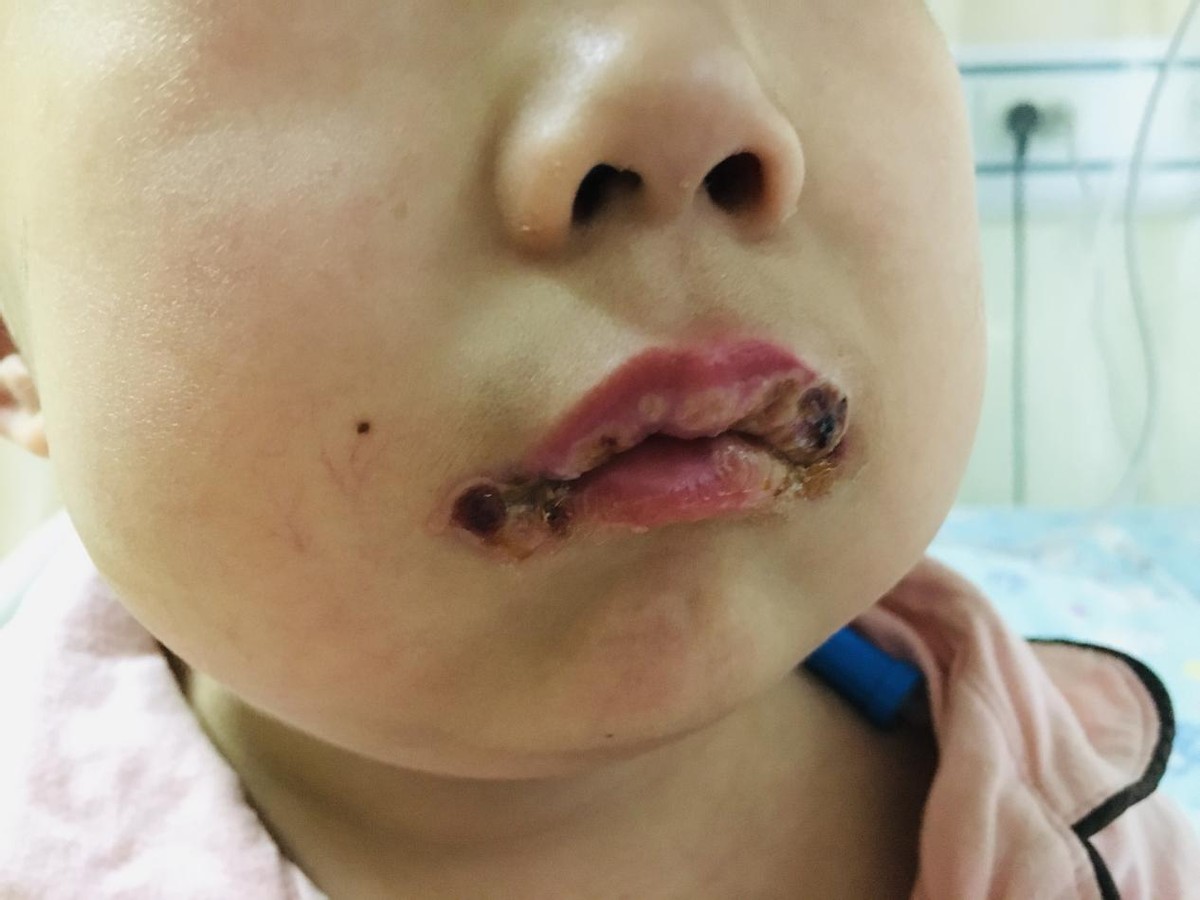 宝宝患重症6天没有进食肚子却鼓胀如球苦苦哀求妈妈带我回家