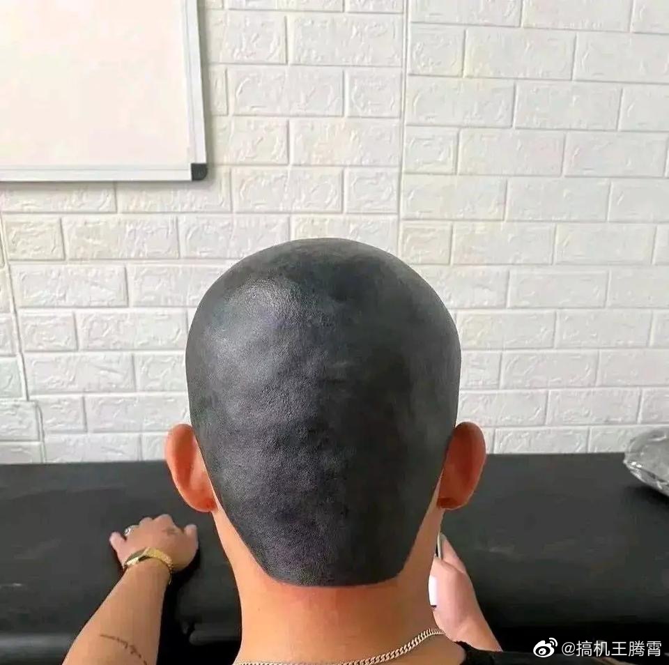 太秀了网友称心血来潮在头上做了个这样的纹身