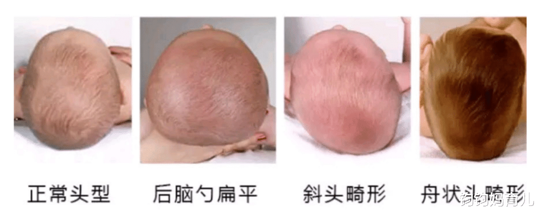 给宝宝睡头型也有黄金期再不干预就晚啦