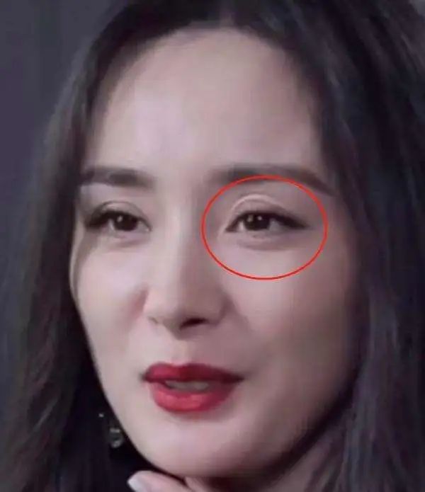 眼睛凹陷才是真毁容从杨幂到陶虹多少女神被害惨