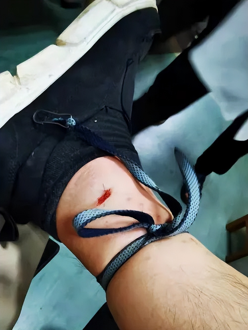 弯腰整理鞋子激怒超级毒蛇！女子被蛇咬伤后，为蛇拍照救了自己休闲区蓝鸢梦想 - Www.slyday.coM