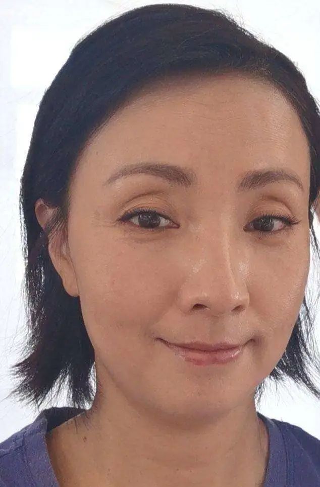 眼睛凹陷才是真毁容从杨幂到陶虹多少女神被害惨