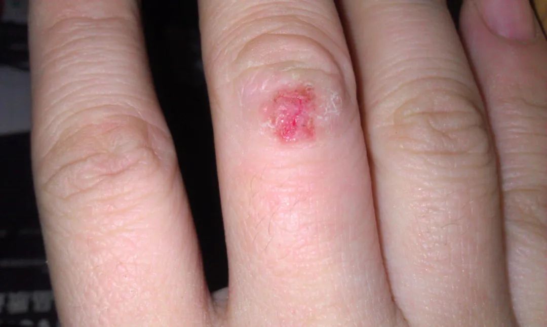 人体免疫力下降时,身体会出现哪些特征表现呢?3大症状需警惕休闲区蓝鸢梦想 - Www.slyday.coM 人体免疫力下降时,身体会出现哪些特征表现呢?3大症状需警惕休闲区蓝鸢梦想 - Www.slyday.coM