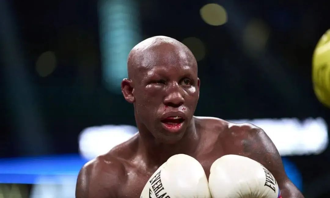 乌加斯透露自己严重的伤痛 眼睛流了四十个小时血泪