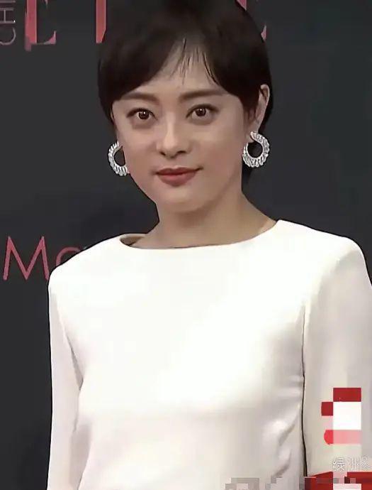 有很多人说孙俪应该是甲状腺出问题了,因为生活中有很多像孙俪这样的