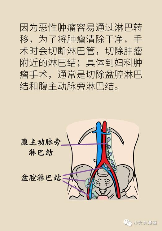 可预防但难治愈这种腿肿要小心