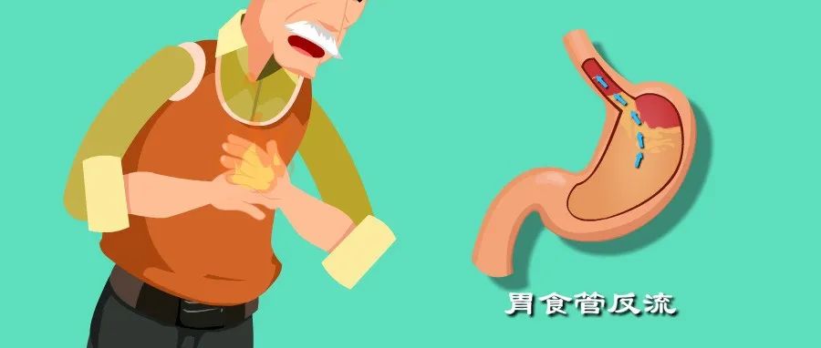 胃食管反流咋回事？反酸烧心背后真相是啥？胃食管反流发病机制动漫版！_新浪新闻
