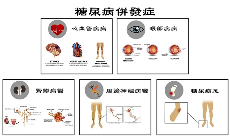 糖尿病并发症要发生身体会发出的这八大信号