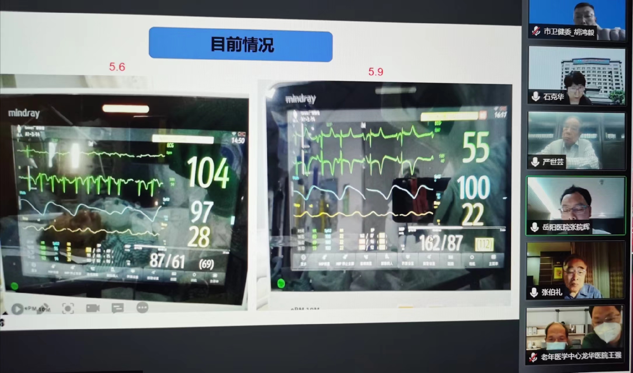 上海一位百岁新冠重症患者治愈出院：采用中西医结合肺康复方案