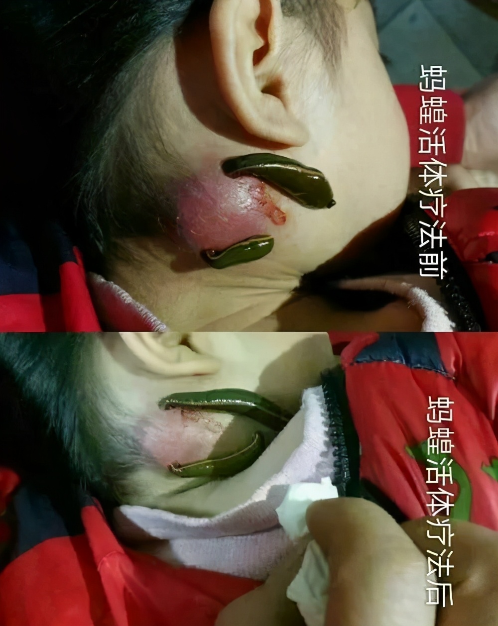 蚂蝗|水蛭|肚子_新浪新闻