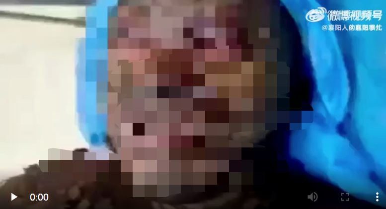 哈尔滨男子被泼汽油烧伤身亡？警方通报来了休闲区蓝鸢梦想 - Www.slyday.coM