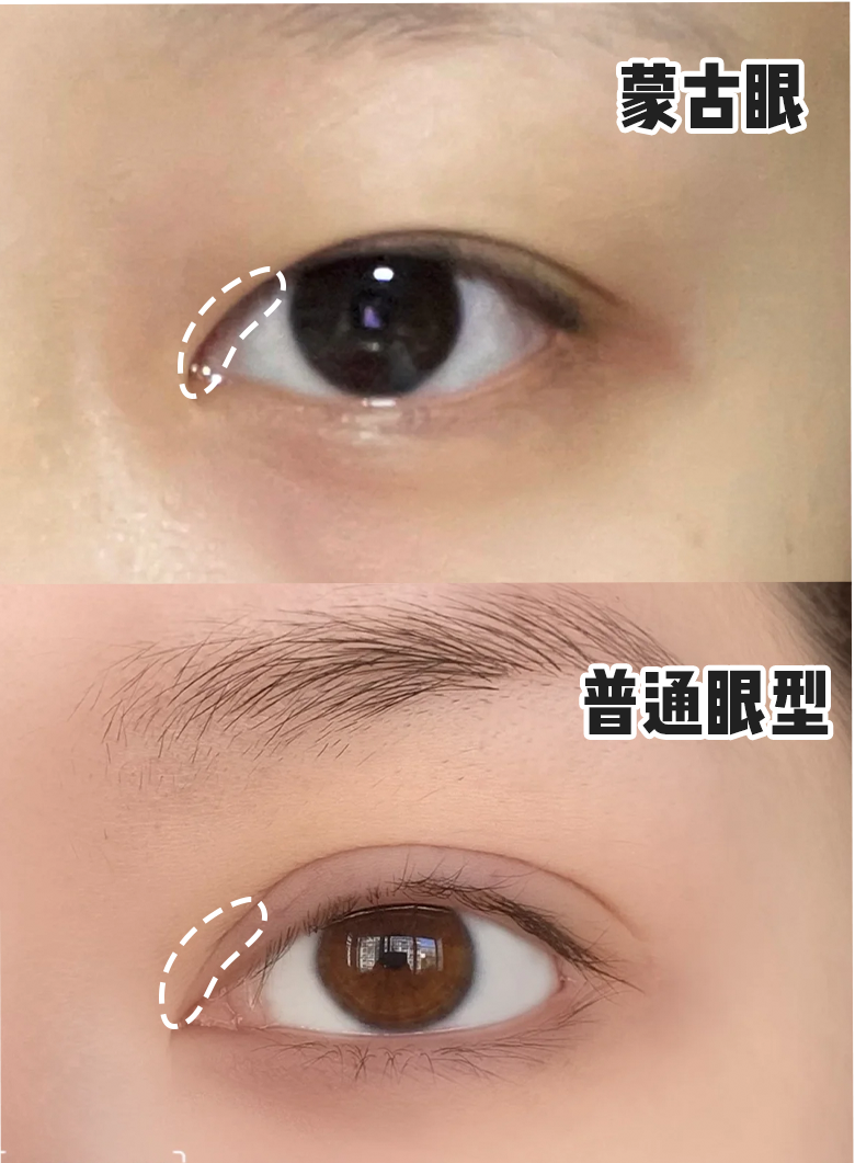 其实这种情况很好办,用一支棕色眼线液笔顺着蒙古褶往下画出一条线