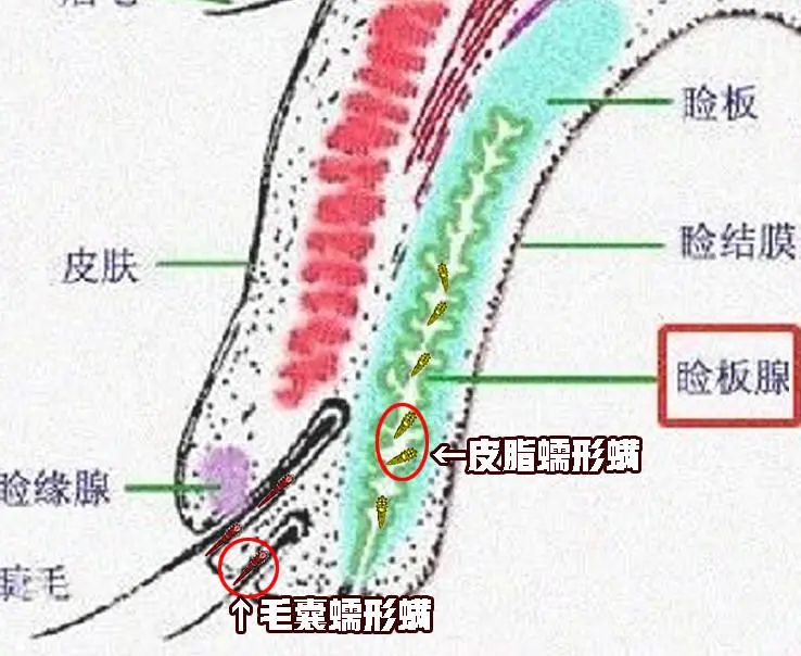 用眼过度小心螨虫在睫毛安家
