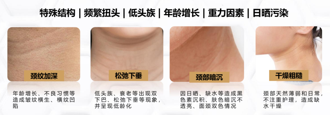 老不老看脖子快来对照你的颈纹是几级