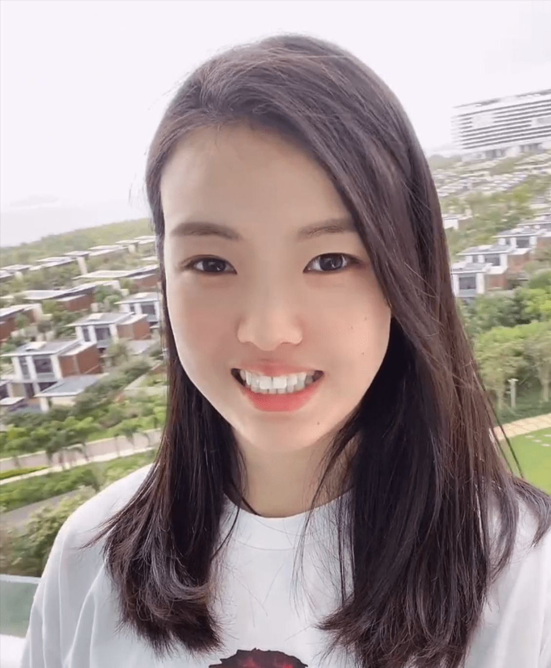 发际线上移加脸型圆润,身材发福大走样,认不出|张常宁|发际线|吴冠希