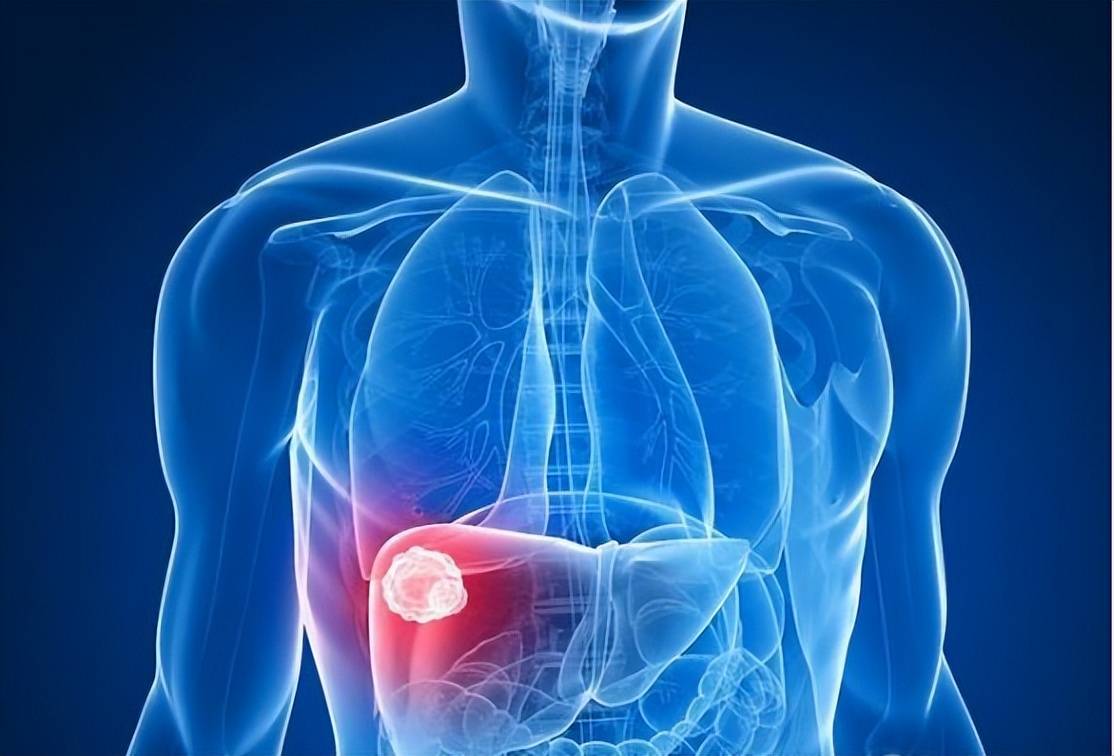 为什么有些人总是会长结节、肌瘤、囊肿?今天来告诉各位答案休闲区蓝鸢梦想 - Www.slyday.coM 为什么有些人总是会长结节、肌瘤、囊肿?今天来告诉各位答案休闲区蓝鸢梦想 - Www.slyday.coM