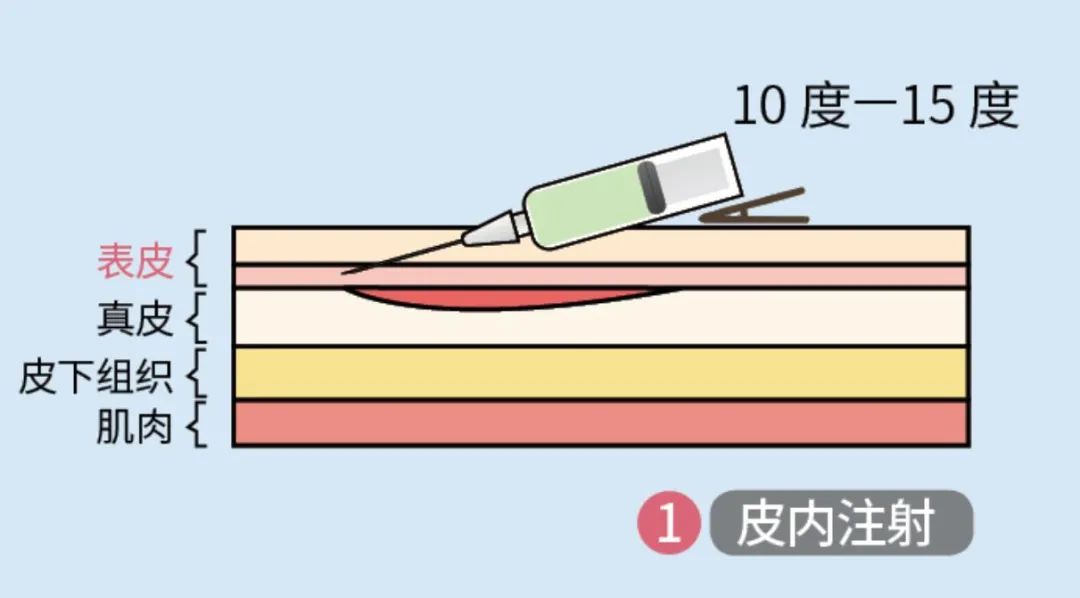 藏文科普让打针几乎没有痛感儿童可以实现无针注射啦这背后隐藏着什么