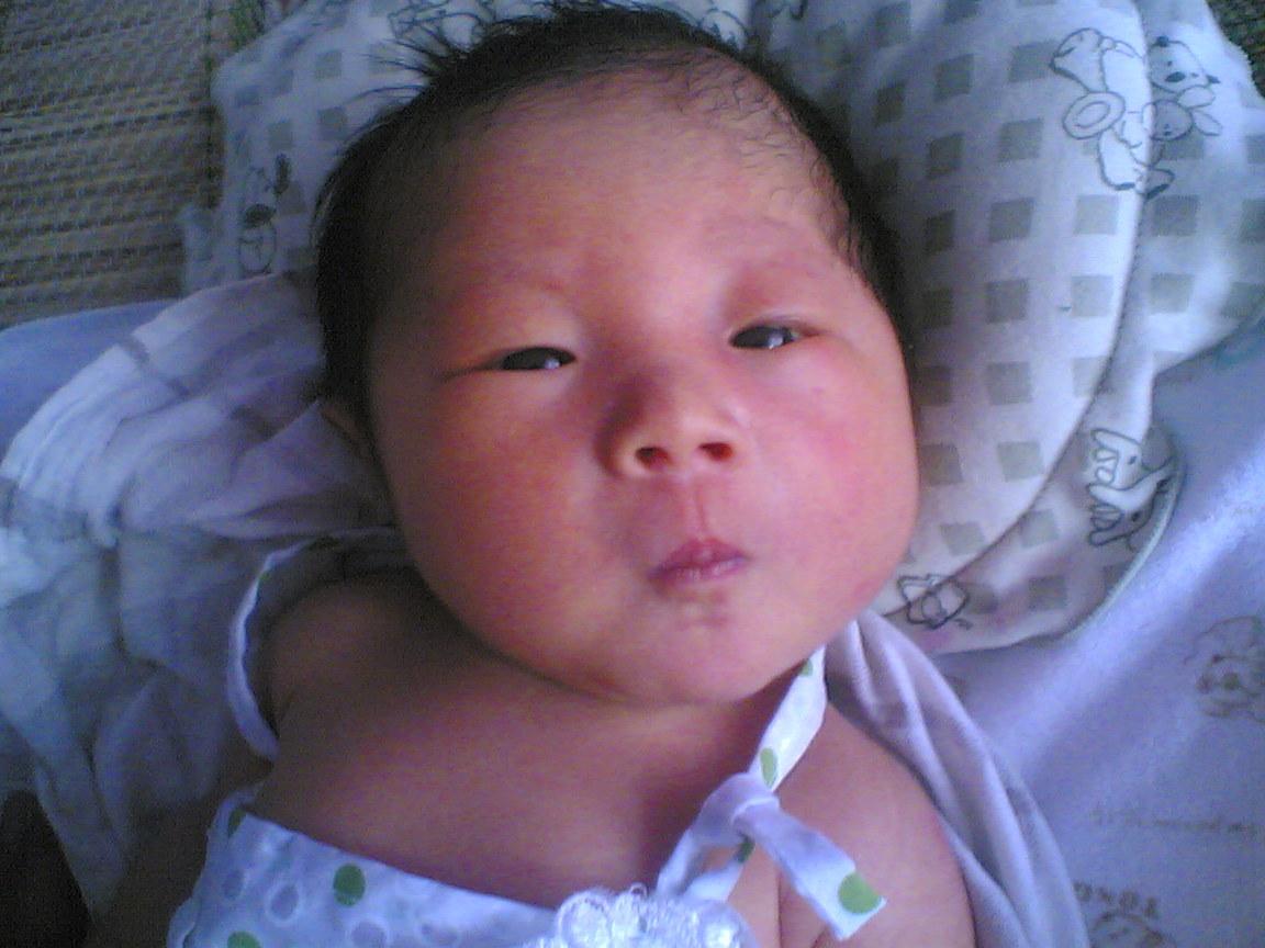 新生儿身上的“淤青”，是在产道中被挤压的，还是被医生拍的？休闲区蓝鸢梦想 - Www.slyday.coM