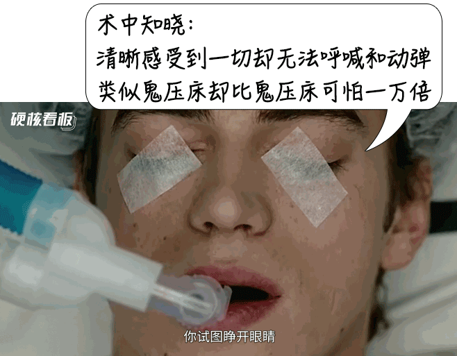 什么全麻机全麻手术会不会变傻？麻醉时经历了什么？_https://www.jmylbn.com_新闻资讯_第8张