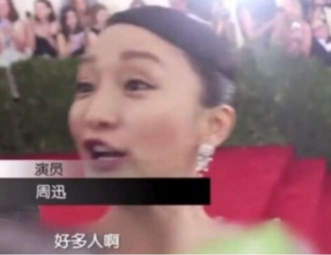 娱乐圈流行起“搞笑女”：金晨玩直播，杨紫摘牙套，还有杨幂……休闲区蓝鸢梦想 - Www.slyday.coM
