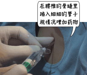 什么全麻机全麻手术会不会变傻？麻醉时经历了什么？_https://www.jmylbn.com_新闻资讯_第12张