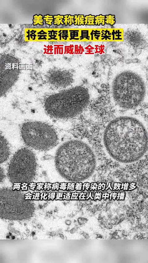 据环球时报5月20日报道,美专家称猴痘病毒将会更具传染性……__财经