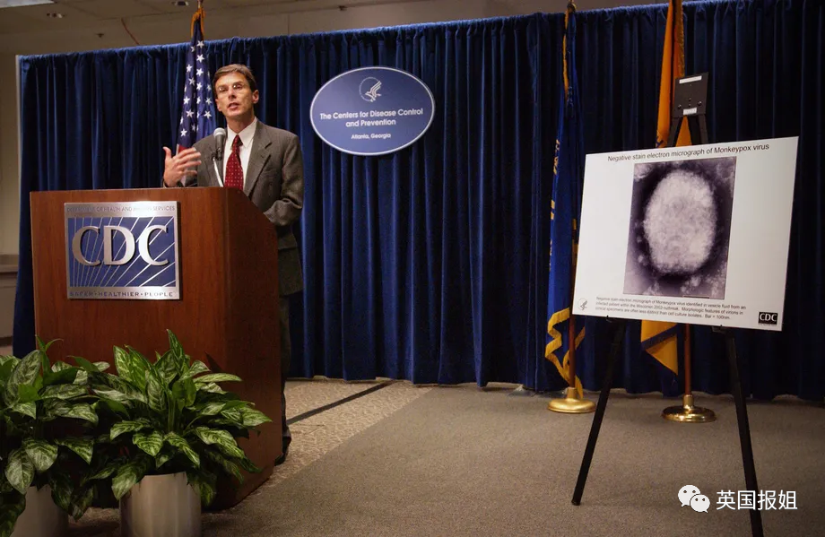 欧美11国突爆猴痘！天花近亲疑似社区传播，美专家：病毒传染变强恐威胁全球休闲区蓝鸢梦想 - Www.slyday.coM