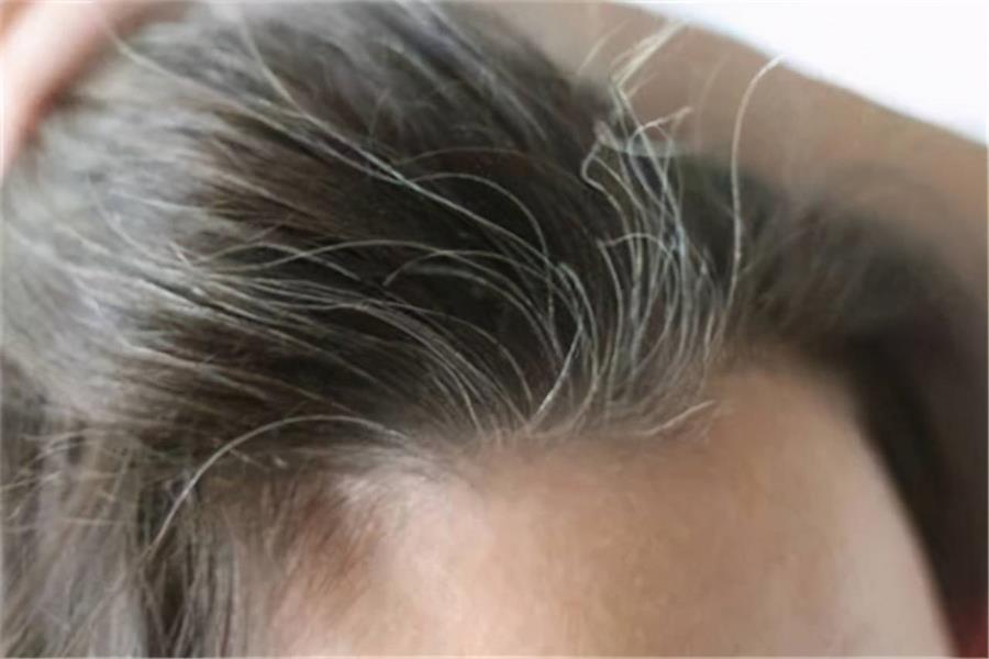 梦见自己掉白头发，预兆与心理解析的深层探索