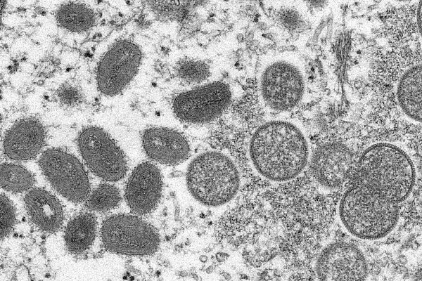 由疾病控制和预防中心提供的电子显微镜图像显示，成熟的猴痘病毒(左)和未成熟病毒粒子(右) 图源：视觉中国