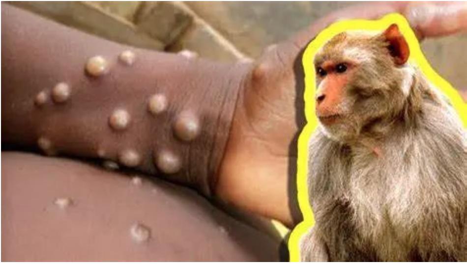 埃博拉病毒起源猴子图片