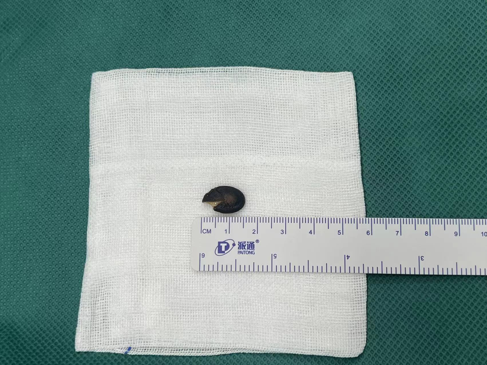 西瓜籽大约有1.5cm的长度(图片由报料人沙先生提供)