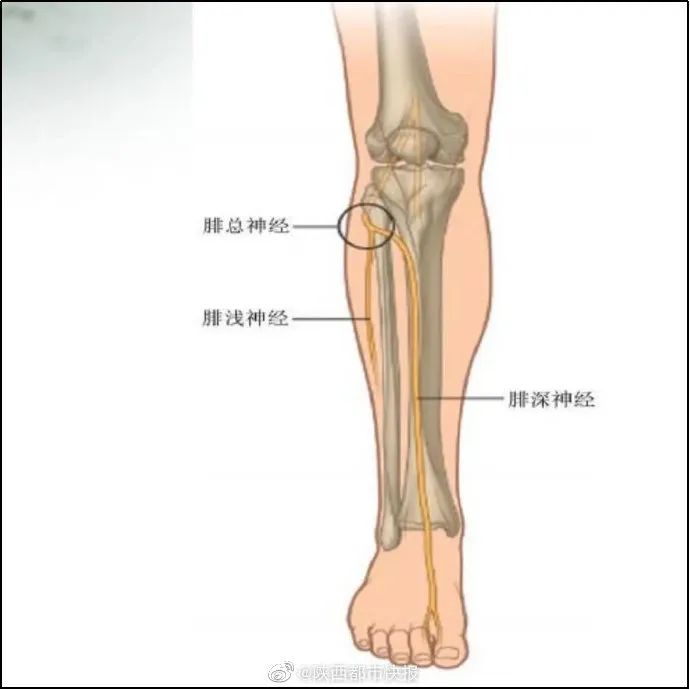 注意西安女子长期习惯干这事已致神经损伤