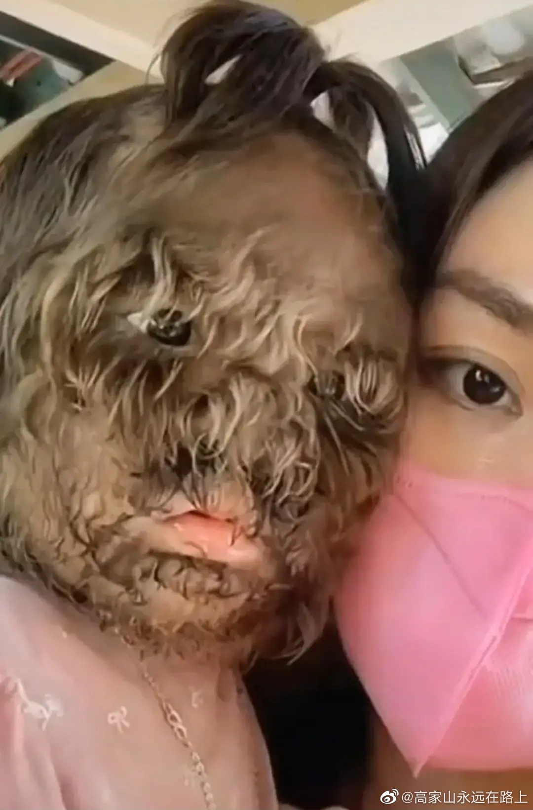 真的假的居然有这样的事情这么小的孩子脸上都是毛