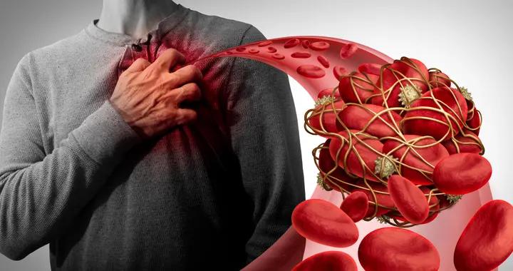 人越老血越稠,就更容易得血栓吗?辟谣了