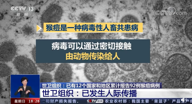 “毁容”病毒!世卫组织发布猴痘疫情预警,欧美多国出现人际传播休闲区蓝鸢梦想 - Www.slyday.coM “毁容”病毒!世卫组织发布猴痘疫情预警,欧美多国出现人际传播休闲区蓝鸢梦想 - Www.slyday.coM