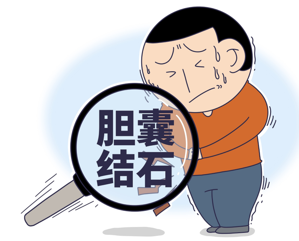 胆结石不切除,会发展成胆囊癌吗?|胆囊结石|胆囊癌|胆囊_新浪新闻